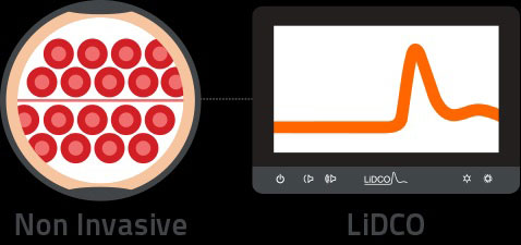 Lidco - LiDCOunity Monitor